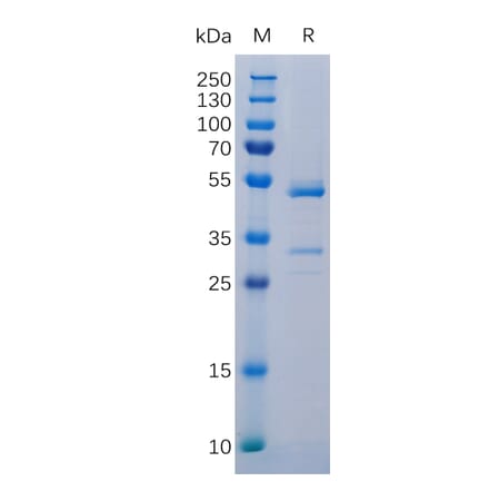 SDS-PAGE - Recombinant Human TWEAK Protein (Fc Tag) (A318313) - Antibodies.com