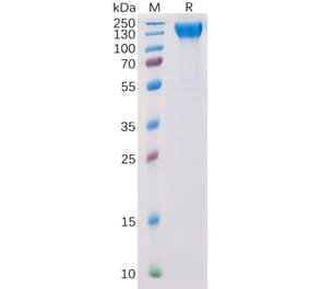 SDS-PAGE - Recombinant Human VEGF Receptor 2 Protein (6×His Tag) (A318314) - Antibodies.com