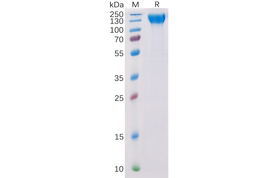 SDS-PAGE - Recombinant Human VEGF Receptor 2 Protein (6×His Tag) (A318314) - Antibodies.com