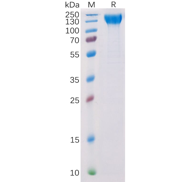 SDS-PAGE - Recombinant Human VEGF Receptor 2 Protein (6×His Tag) (A318314) - Antibodies.com