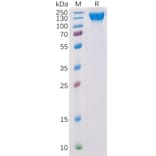 SDS-PAGE - Recombinant Human VEGF Receptor 2 Protein (6×His Tag) (A318314) - Antibodies.com