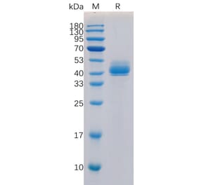 SDS-PAGE - Recombinant Human TGF beta Receptor I Protein (Fc Tag) (A318315) - Antibodies.com