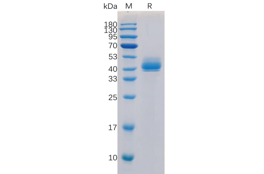 SDS-PAGE - Recombinant Human TGF beta Receptor I Protein (Fc Tag) (A318315) - Antibodies.com