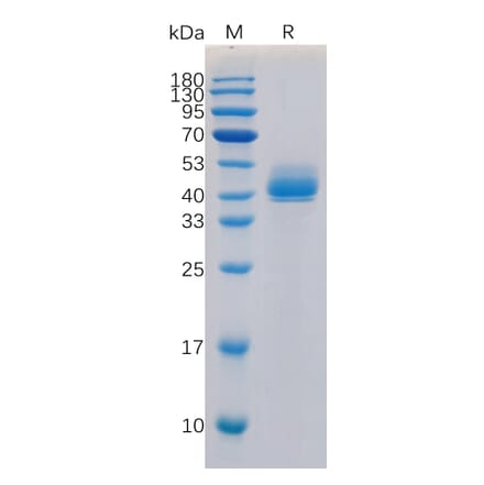 SDS-PAGE - Recombinant Human TGF beta Receptor I Protein (Fc Tag) (A318315) - Antibodies.com
