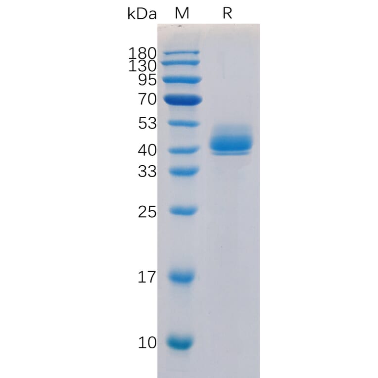 SDS-PAGE - Recombinant Human TGF beta Receptor I Protein (Fc Tag) (A318315) - Antibodies.com