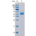 SDS-PAGE - Recombinant Human TGF beta Receptor I Protein (Fc Tag) (A318315) - Antibodies.com