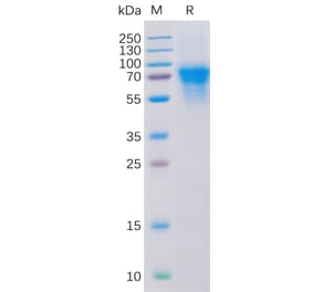 SDS-PAGE - Recombinant Human CD46 Protein (6×His Tag) (A318316) - Antibodies.com