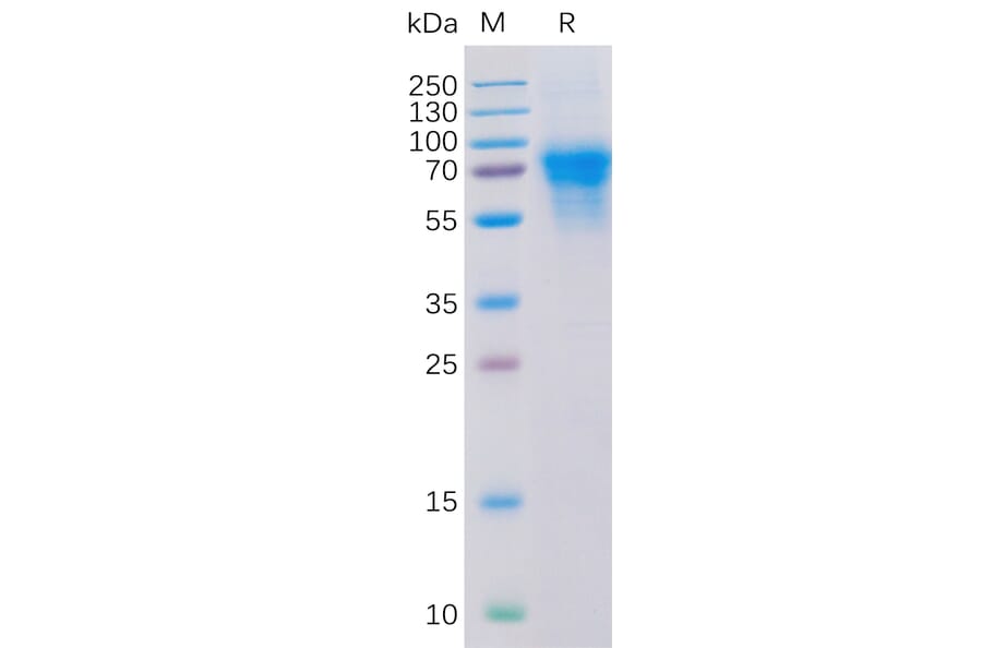 SDS-PAGE - Recombinant Human CD46 Protein (6×His Tag) (A318316) - Antibodies.com