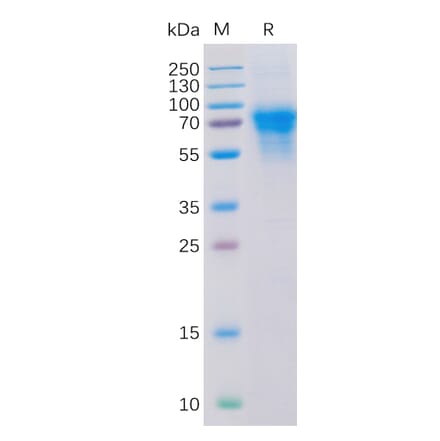 SDS-PAGE - Recombinant Human CD46 Protein (6×His Tag) (A318316) - Antibodies.com