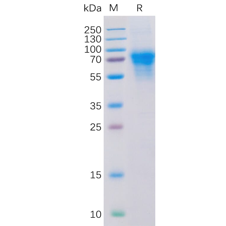 SDS-PAGE - Recombinant Human CD46 Protein (6×His Tag) (A318316) - Antibodies.com