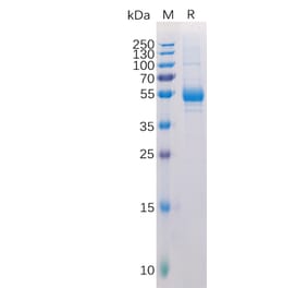 SDS-PAGE - Recombinant Human RANKL Protein (Fc Tag) (A318317) - Antibodies.com