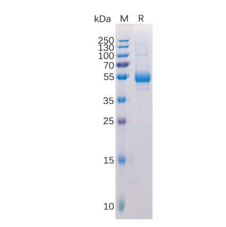 SDS-PAGE - Recombinant Human RANKL Protein (Fc Tag) (A318317) - Antibodies.com