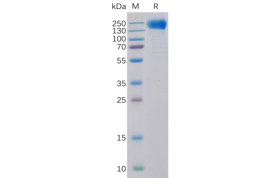 SDS-PAGE - Recombinant Human EGFR Protein (6×His Tag) (A318318) - Antibodies.com