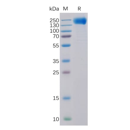 SDS-PAGE - Recombinant Human EGFR Protein (6×His Tag) (A318318) - Antibodies.com