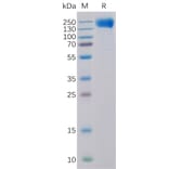 SDS-PAGE - Recombinant Human EGFR Protein (6×His Tag) (A318318) - Antibodies.com