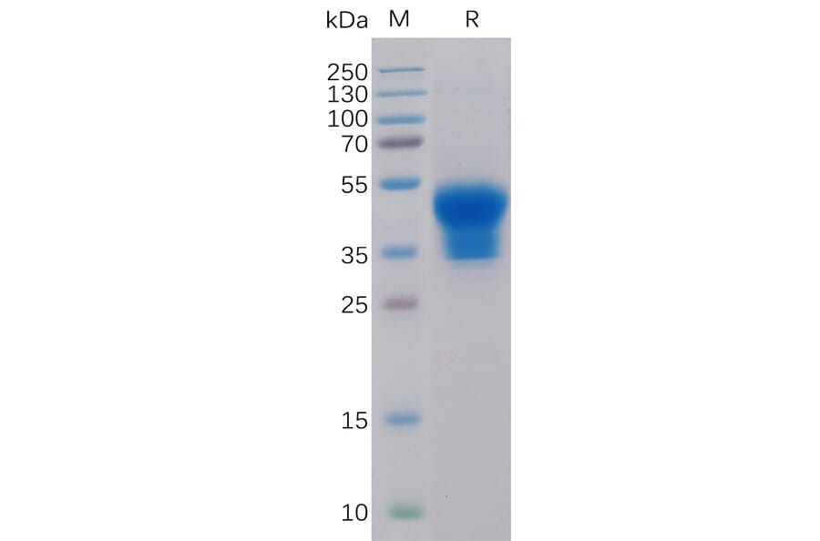 SDS-PAGE - Recombinant Human IL-2 Receptor alpha Protein (6×His Tag) (A318319) - Antibodies.com