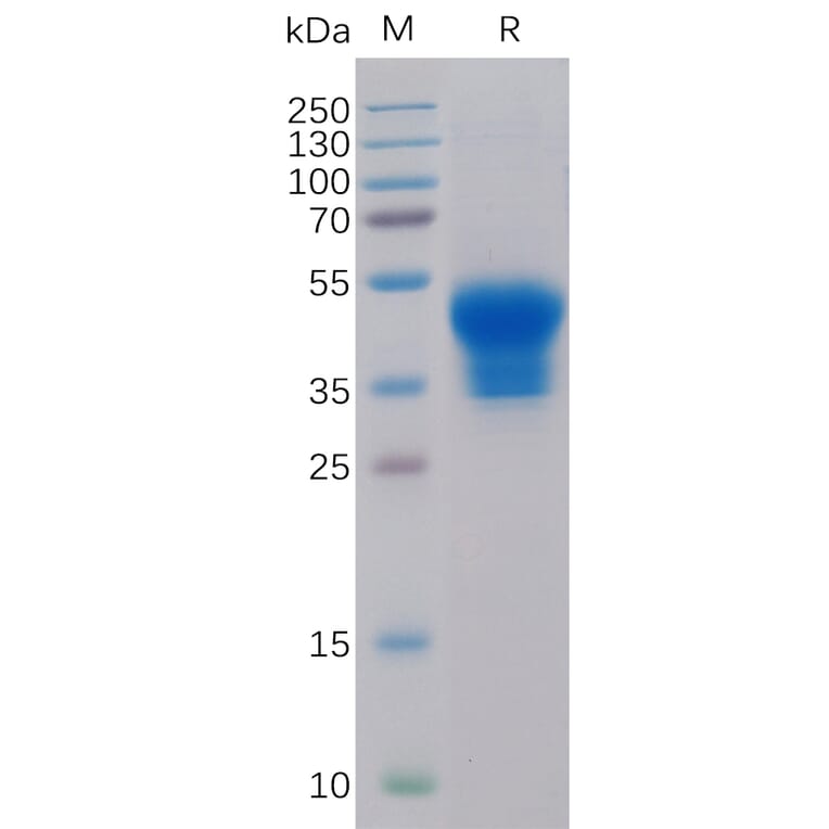 SDS-PAGE - Recombinant Human IL-2 Receptor alpha Protein (6×His Tag) (A318319) - Antibodies.com