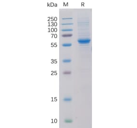 SDS-PAGE - Recombinant Human ROR2 Protein (6×His Tag) (A318320) - Antibodies.com