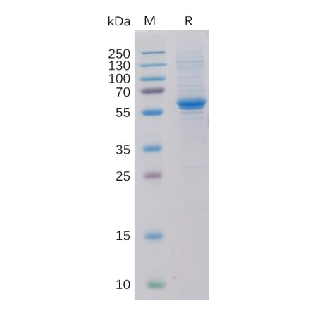 SDS-PAGE - Recombinant Human ROR2 Protein (6×His Tag) (A318320) - Antibodies.com