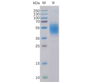 SDS-PAGE - Recombinant Human CLEC12A Protein (6×His Tag) (A318321) - Antibodies.com