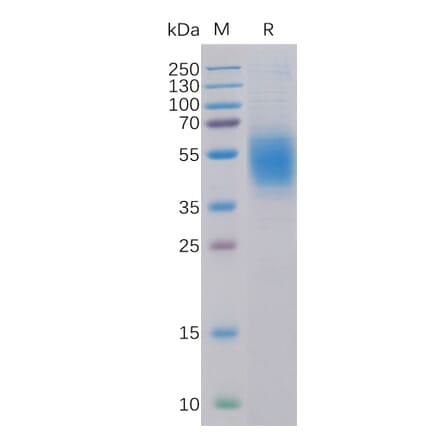 SDS-PAGE - Recombinant Human CLEC12A Protein (6×His Tag) (A318321) - Antibodies.com