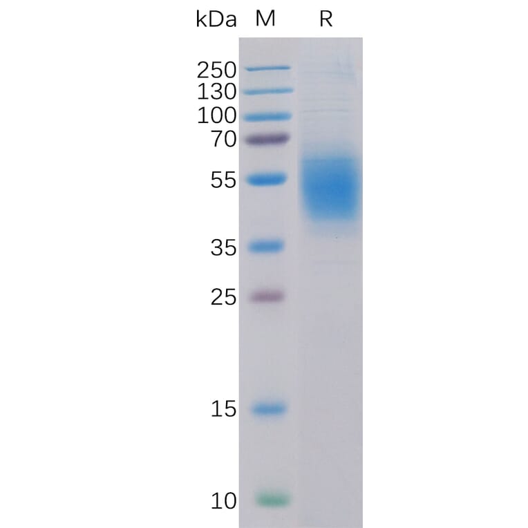 SDS-PAGE - Recombinant Human CLEC12A Protein (6×His Tag) (A318321) - Antibodies.com