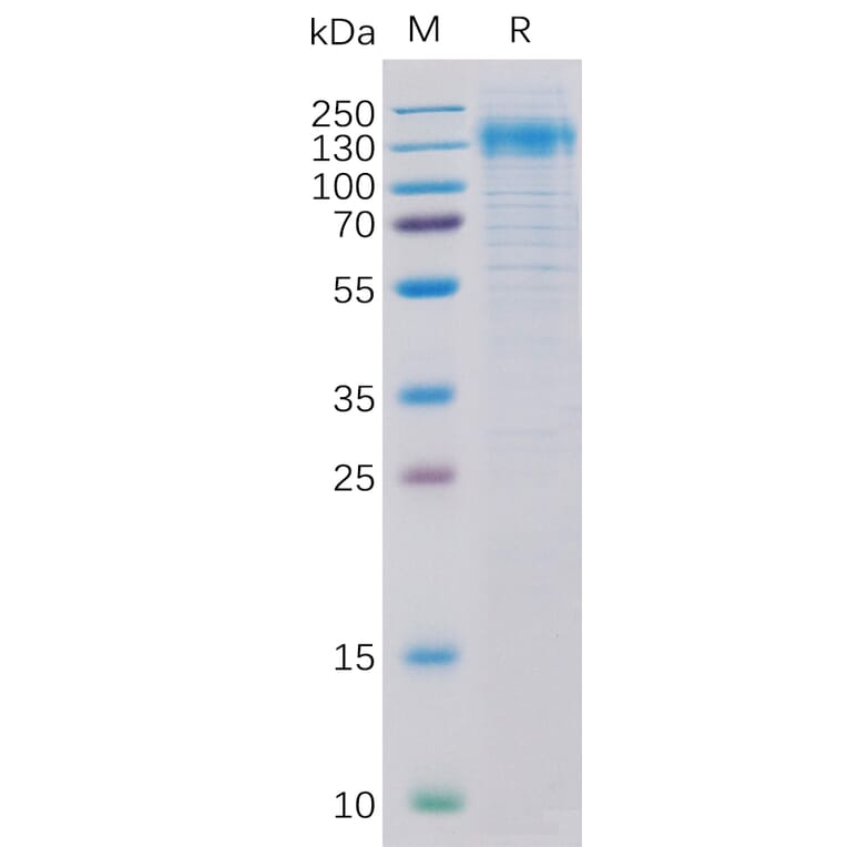 SDS-PAGE - Recombinant Human ErbB2/HER2 Protein (6×His Tag) (A318322) - Antibodies.com