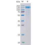 SDS-PAGE - Recombinant Human ErbB2/HER2 Protein (6×His Tag) (A318322) - Antibodies.com