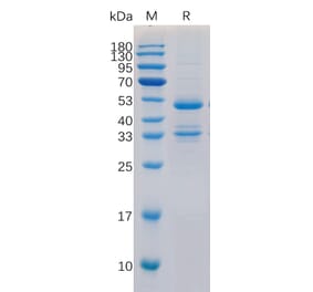 SDS-PAGE - Recombinant Human TACI Protein (Fc Tag) (A318323) - Antibodies.com