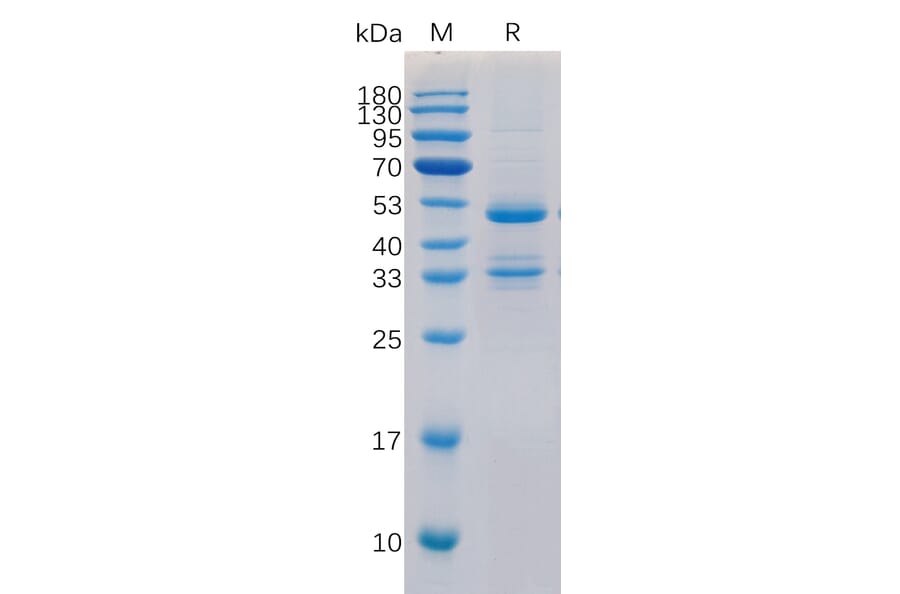 SDS-PAGE - Recombinant Human TACI Protein (Fc Tag) (A318323) - Antibodies.com
