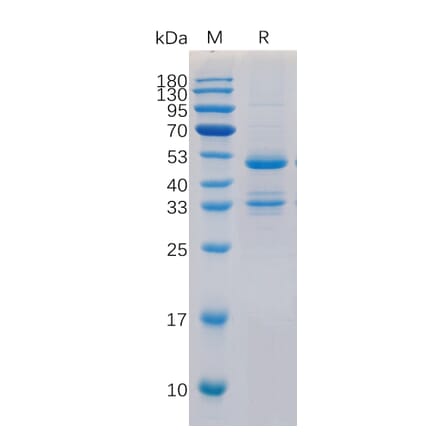 SDS-PAGE - Recombinant Human TACI Protein (Fc Tag) (A318323) - Antibodies.com