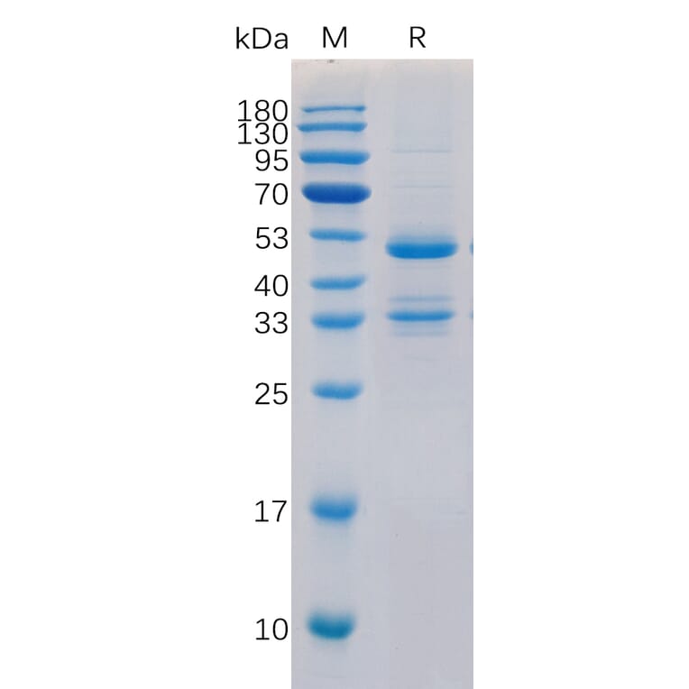 SDS-PAGE - Recombinant Human TACI Protein (Fc Tag) (A318323) - Antibodies.com