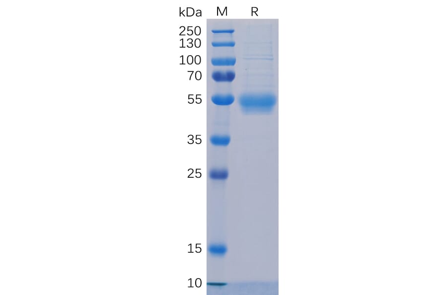 SDS-PAGE - Recombinant Human IL-5RA Protein (6×His Tag) (A318324) - Antibodies.com