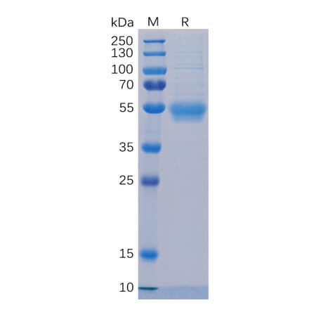 SDS-PAGE - Recombinant Human IL-5RA Protein (6×His Tag) (A318324) - Antibodies.com