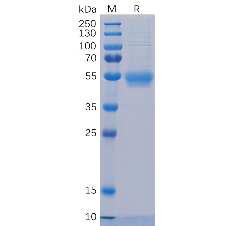 SDS-PAGE - Recombinant Human IL-5RA Protein (6×His Tag) (A318324) - Antibodies.com