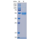 SDS-PAGE - Recombinant Human IL-5RA Protein (6×His Tag) (A318324) - Antibodies.com