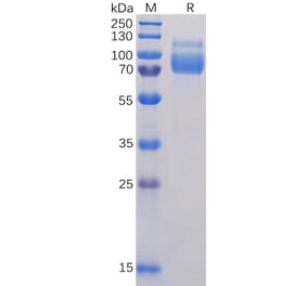 SDS-PAGE - Recombinant Human SIGLEC10 Protein (6×His Tag) (A318325) - Antibodies.com