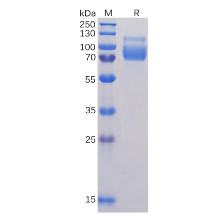 SDS-PAGE - Recombinant Human SIGLEC10 Protein (6×His Tag) (A318325) - Antibodies.com