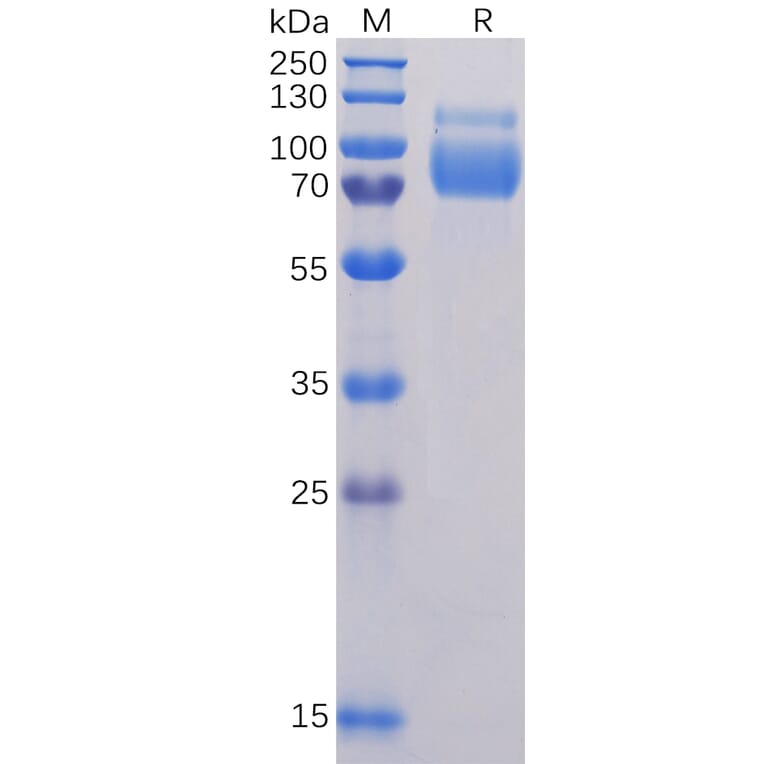 SDS-PAGE - Recombinant Human SIGLEC10 Protein (6×His Tag) (A318325) - Antibodies.com