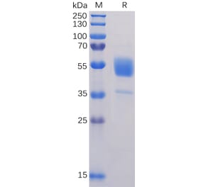 SDS-PAGE - Recombinant Human CD37 Protein (Fc Tag) (A318326) - Antibodies.com