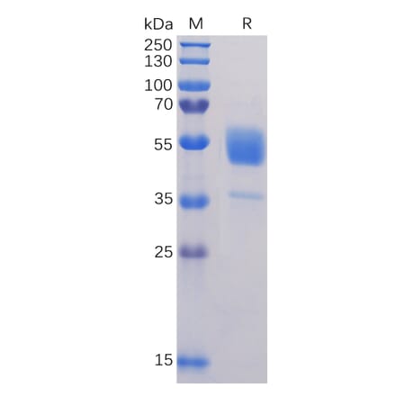 SDS-PAGE - Recombinant Human CD37 Protein (Fc Tag) (A318326) - Antibodies.com