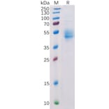 SDS-PAGE - Recombinant Human PVRIG/CD112R Protein (Fc Tag) (A318327) - Antibodies.com