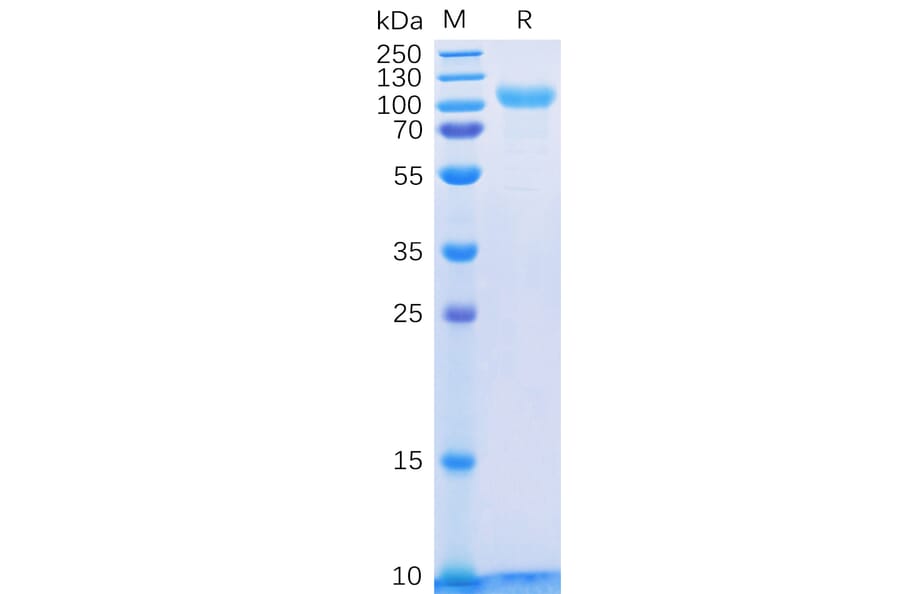 SDS-PAGE - Recombinant Human ErbB3/HER3 Protein (6×His Tag) (A318328) - Antibodies.com