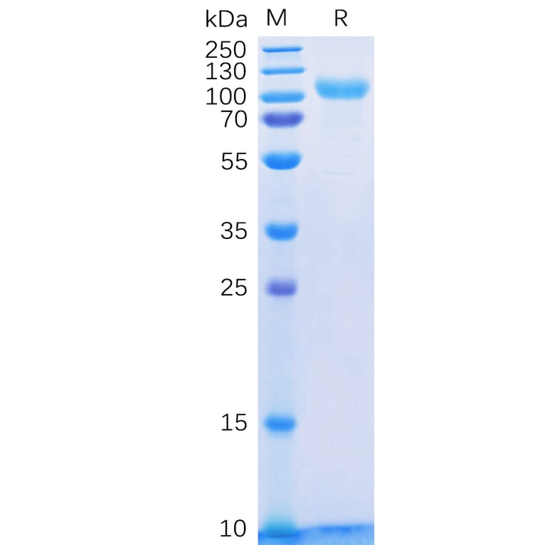 SDS-PAGE - Recombinant Human ErbB3/HER3 Protein (6×His Tag) (A318328) - Antibodies.com