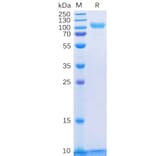SDS-PAGE - Recombinant Human ErbB3/HER3 Protein (6×His Tag) (A318328) - Antibodies.com