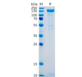 SDS-PAGE - Recombinant Human P-Selectin Protein (Fc Tag) (A318329) - Antibodies.com