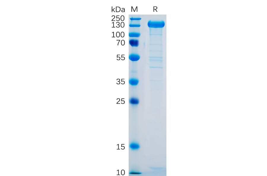 SDS-PAGE - Recombinant Human P-Selectin Protein (Fc Tag) (A318329) - Antibodies.com