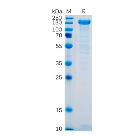 SDS-PAGE - Recombinant Human P-Selectin Protein (Fc Tag) (A318329) - Antibodies.com