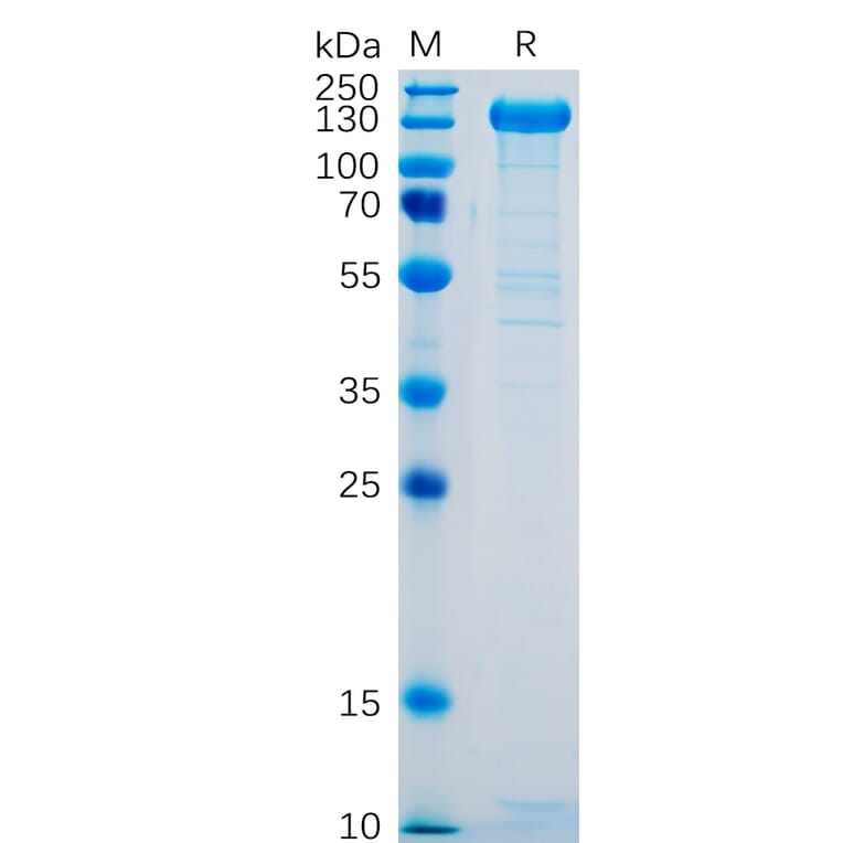 SDS-PAGE - Recombinant Human P-Selectin Protein (Fc Tag) (A318329) - Antibodies.com