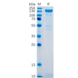 SDS-PAGE - Recombinant Human P-Selectin Protein (Fc Tag) (A318329) - Antibodies.com